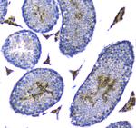 Doppel Antibody in Immunohistochemistry (Paraffin) (IHC (P))