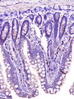 RASAL1 Antibody in Immunohistochemistry (Paraffin) (IHC (P))