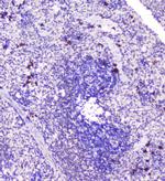 RASAL1 Antibody in Immunohistochemistry (Paraffin) (IHC (P))