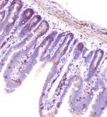 RASAL1 Polyclonal Antibody