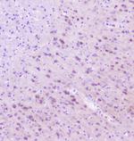 RASAL1 Antibody in Immunohistochemistry (Paraffin) (IHC (P))