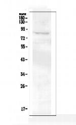 RXFP2 Antibody in Western Blot (WB)