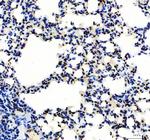 SP1 Antibody in Immunohistochemistry (Paraffin) (IHC (P))