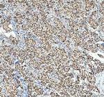 SP1 Antibody in Immunohistochemistry (Paraffin) (IHC (P))