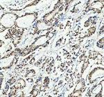 SP1 Antibody in Immunohistochemistry (Paraffin) (IHC (P))