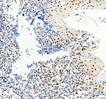 SP1 Antibody in Immunohistochemistry (Paraffin) (IHC (P))