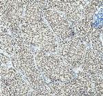 SP1 Antibody in Immunohistochemistry (Paraffin) (IHC (P))