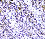 TANK Polyclonal Antibody