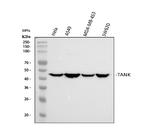 TANK Antibody in Western Blot (WB)