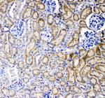 TNFR1 Polyclonal Antibody