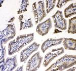 TNFR1 Antibody in Immunohistochemistry (Paraffin) (IHC (P))