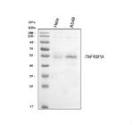 TNFR1 Antibody in Western Blot (WB)