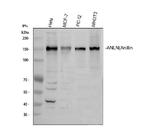 Anillin Antibody in Western Blot (WB)