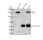 Anillin Antibody in Western Blot (WB)