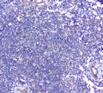 BTLA Polyclonal Antibody