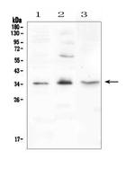 FGF23 Polyclonal Antibody