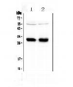 HLA-DRB1 Polyclonal Antibody