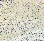 PKC beta-1 Polyclonal Antibody