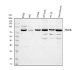 PKC beta-1 Antibody in Western Blot (WB)