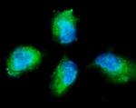 PKC gamma Polyclonal Antibody