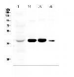 AKR1D1 Polyclonal Antibody