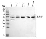 CDK8 Polyclonal Antibody