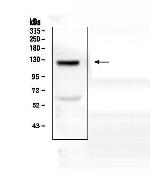 COL17A1 Polyclonal Antibody