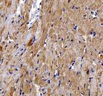 DOK7 Antibody in Immunohistochemistry (Paraffin) (IHC (P))