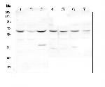 DOK7 Antibody in Western Blot (WB)