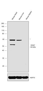DOK7 Antibody in Western Blot (WB)