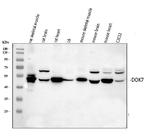 DOK7 Antibody in Western Blot (WB)