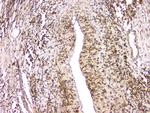 HECTD3 Antibody in Immunohistochemistry (Paraffin) (IHC (P))