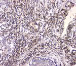 HECTD3 Polyclonal Antibody