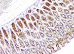 HECTD3 Antibody in Immunohistochemistry (Paraffin) (IHC (P))