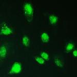 KBTBD2 Antibody in Immunocytochemistry (ICC/IF)