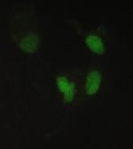 PPCS Polyclonal Antibody