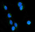 RhoB Antibody in Immunocytochemistry (ICC/IF)