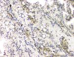 RhoB Antibody in Immunohistochemistry (Paraffin) (IHC (P))