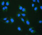 RRBP1 Polyclonal Antibody
