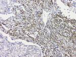 RRBP1 Antibody in Immunohistochemistry (Paraffin) (IHC (P))