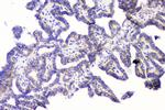 RRBP1 Antibody in Immunohistochemistry (Paraffin) (IHC (P))