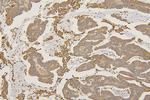 SFRP1 Antibody in Immunohistochemistry (Paraffin) (IHC (P))