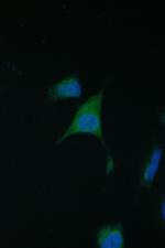 TIM17 Polyclonal Antibody