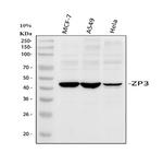 ZP3 Polyclonal Antibody