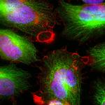 MARCKS Polyclonal Antibody