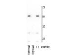 MKNK2A Polyclonal Antibody