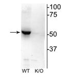 CHRNB2 Polyclonal Antibody
