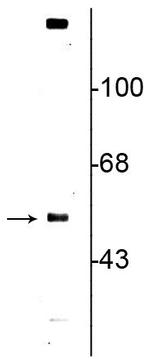VMAT2 Polyclonal Antibody