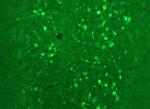 Calretinin Polyclonal Antibody
