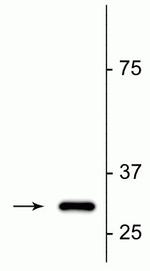 Fractin Antibody in Western Blot (WB)